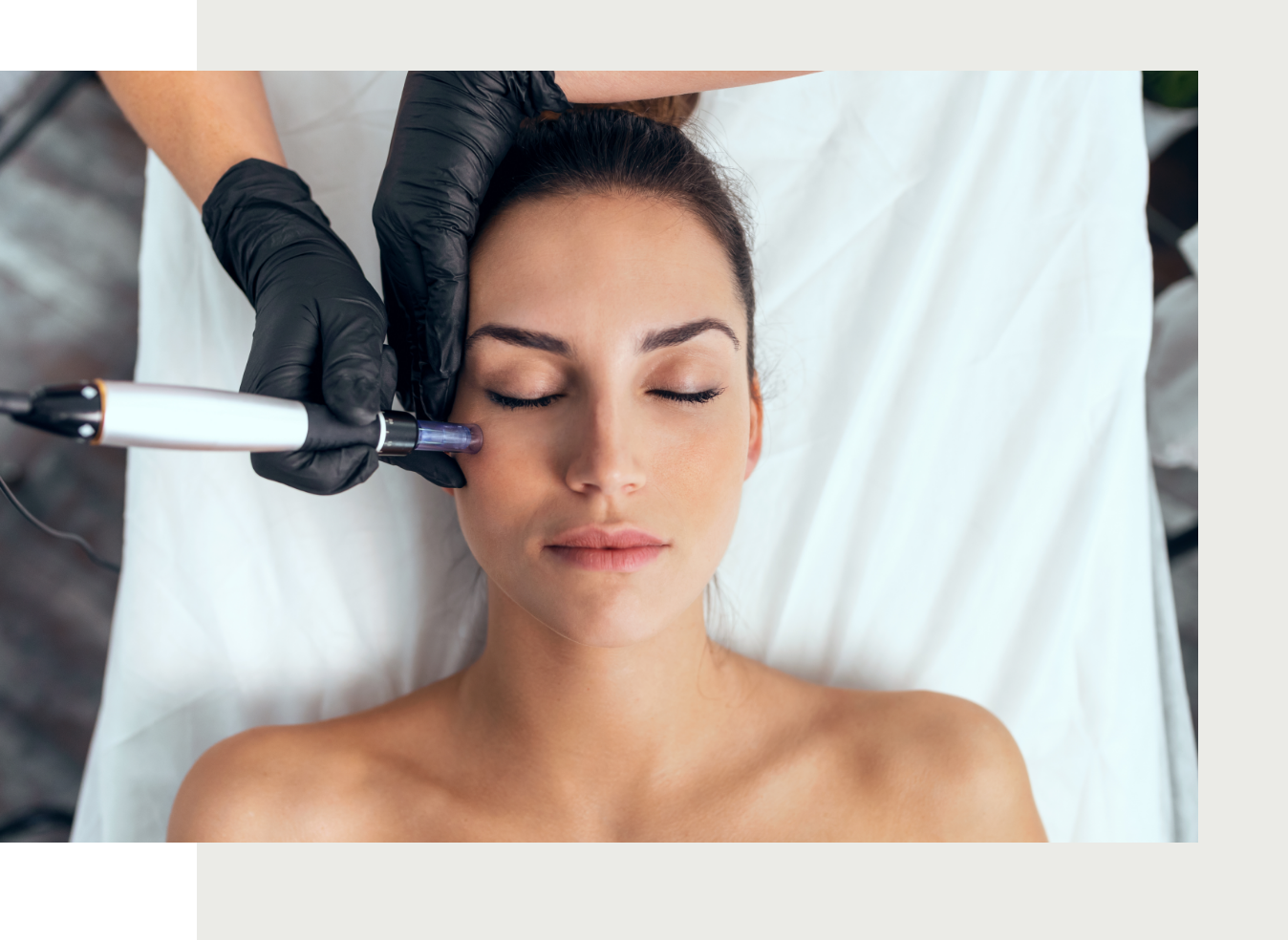 a woman taking microneedling