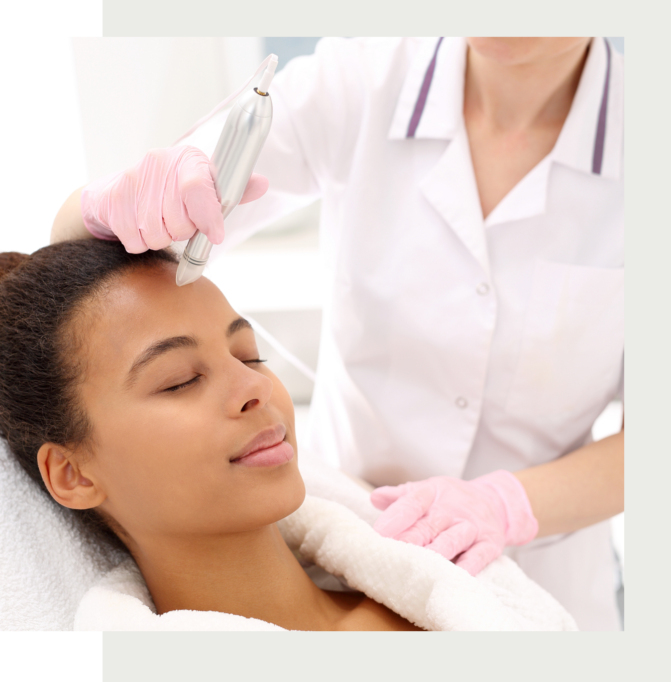 micro needling mississauga